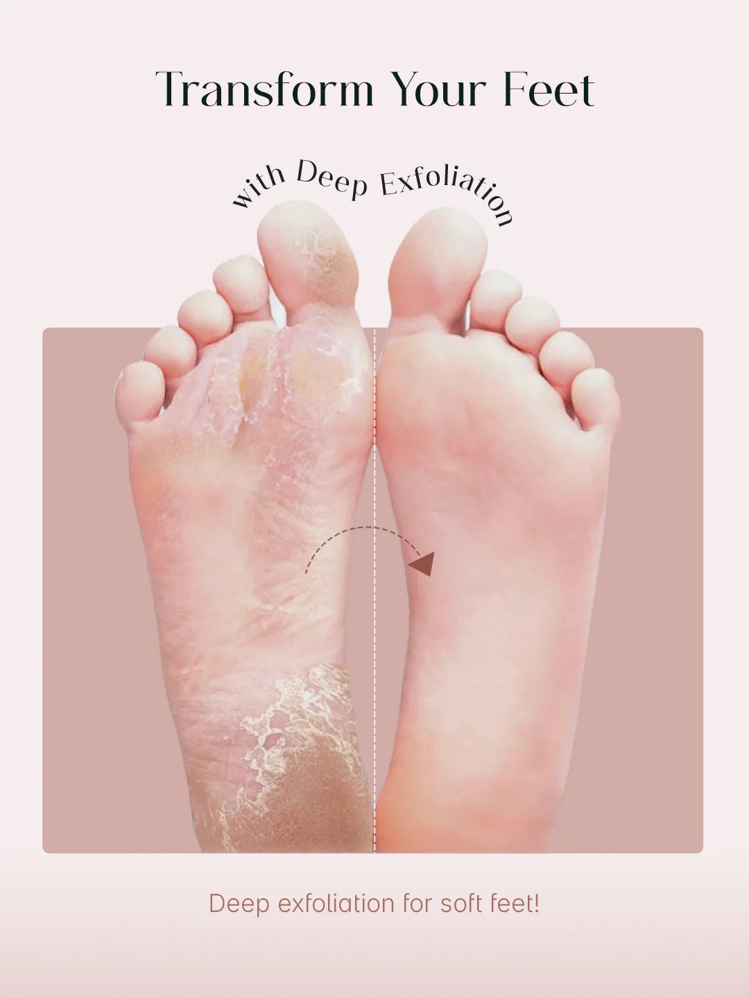 Herwell Glycolic Acid Foot Peeling Mask