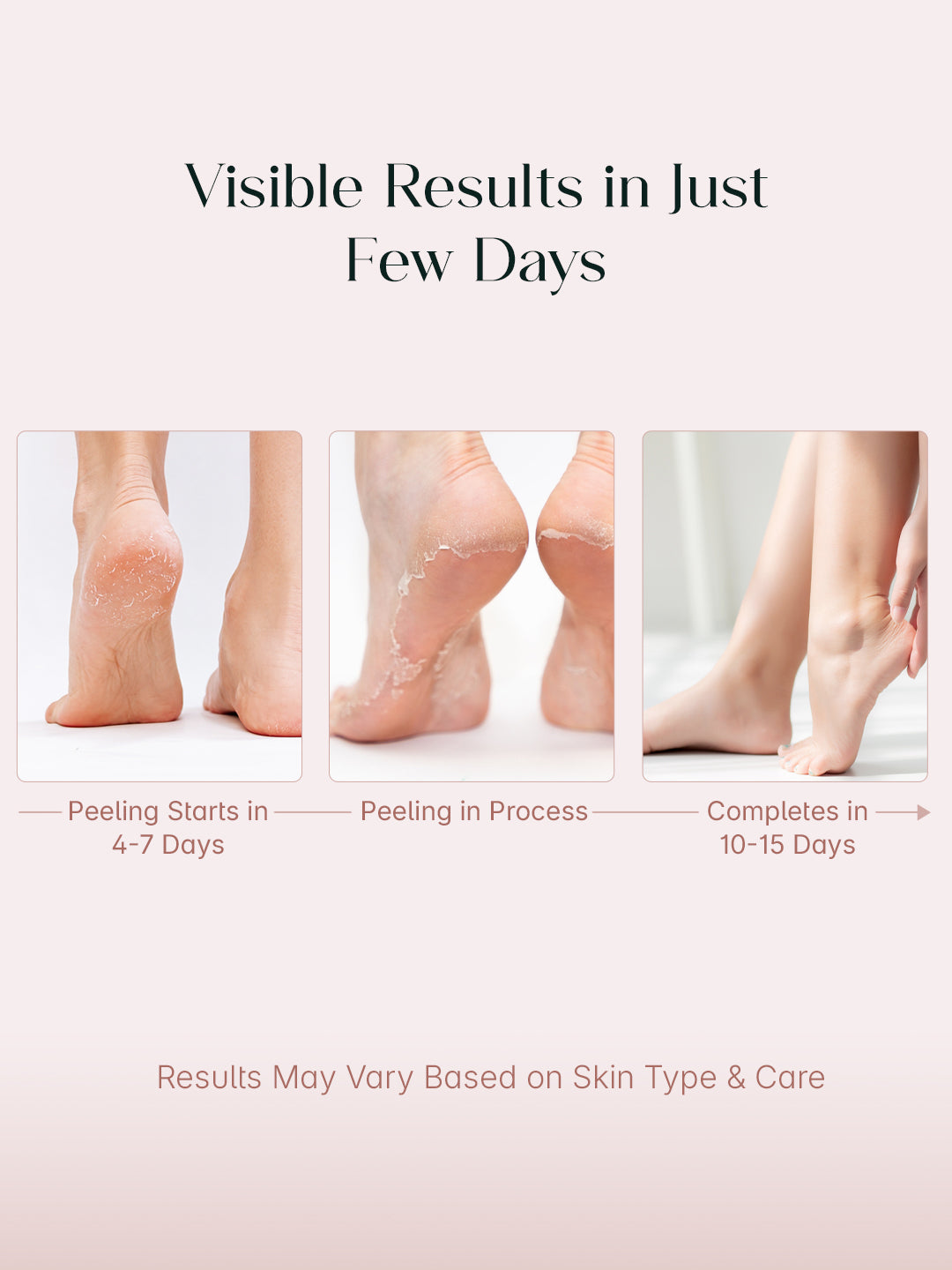 Herwell Glycolic Acid Foot Peeling Mask