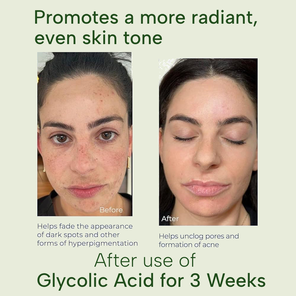 Glycolic Acid 7% Exfoliating Toner