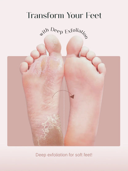 Herwell Glycolic Acid Foot Peeling Mask